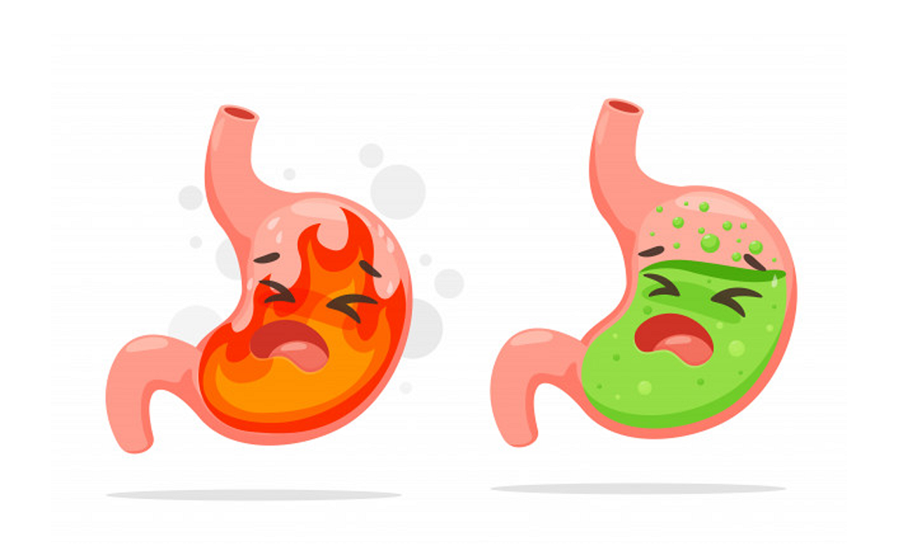 Bệnh trào ngược dạ dày – Triệu chứng, nguyên nhân