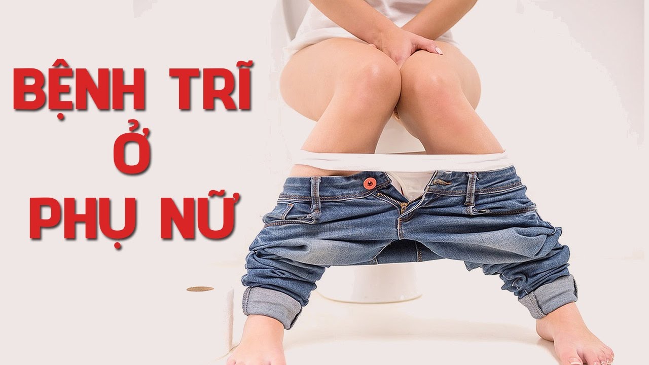 Bệnh trĩ ở nữ giới và cách điều trị hiệu quả