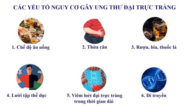 Bệnh ung thư đại tràng: Những thông tin cần biết