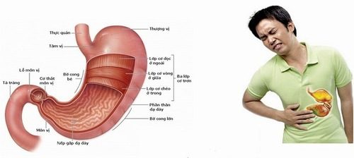 Bệnh viêm dạ dày cấp tính có nguy hiểm không?