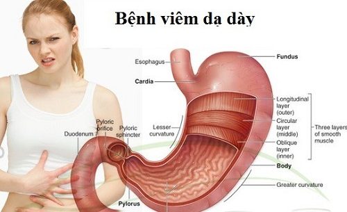 Bệnh viêm dạ dày có khó chữa không?