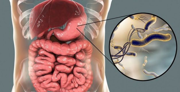 Bệnh viêm dạ dày HP: Hiểu đúng để điều trị hiệu quả