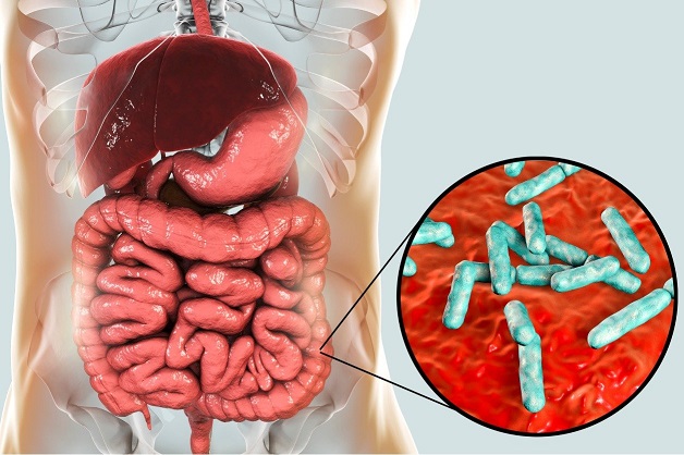 Bệnh viêm đại tràng mãn tính: Triệu chứng và điều trị