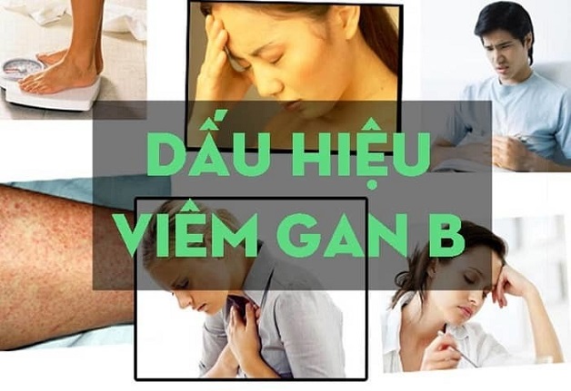 Bệnh viêm gan B sống được bao lâu và cần điều trị thế nào?