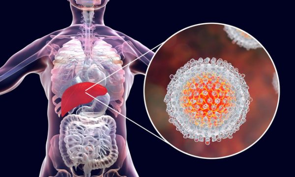 Bệnh viêm gan C: Kẻ hủy diệt thầm lặng tuyệt đối không thể chủ quan