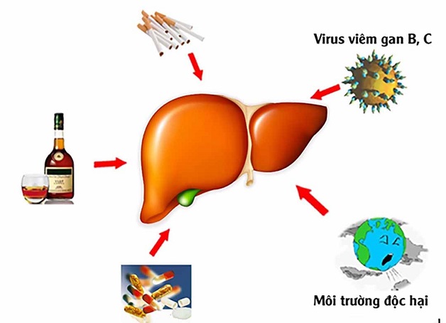 Bệnh viêm gan C – Những điều bạn cần biết