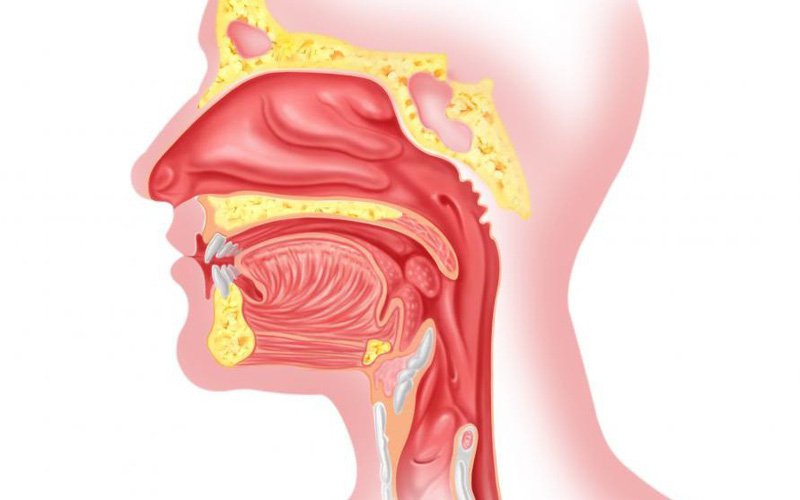 Bệnh viêm mũi họng: Nguyên nhân và điều trị