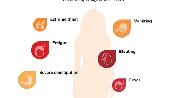 Bệnh viêm phúc mạc – Tất tần tật các vấn đề cần lưu ý