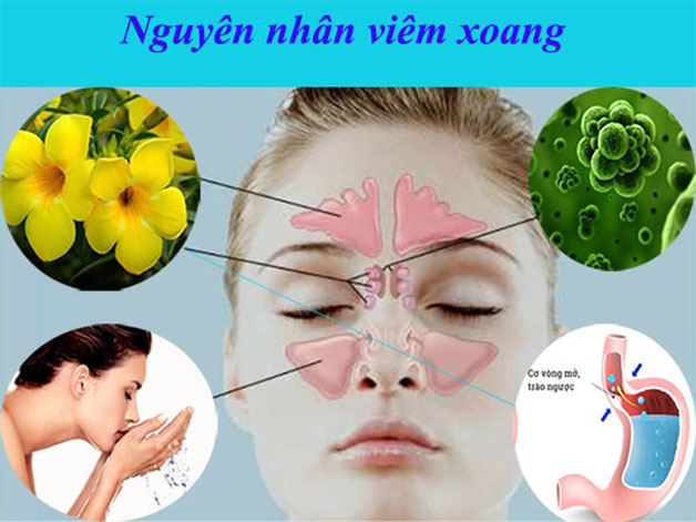 Bệnh viêm xoang mũi có nguy hiểm không và nguyên tắc điều trị