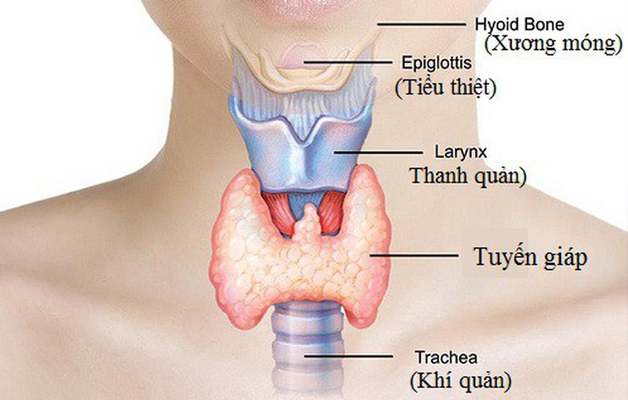 Bị bệnh tuyến giáp nên ăn gì và không nên ăn gì