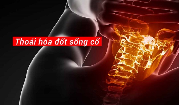 Bị đau nửa đầu kéo dài coi chừng dễ mắc bệnh sau