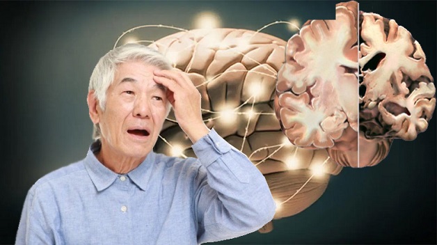 Bí quyết phòng ngừa hội chứng Alzheimer (bệnh Alzheimer)