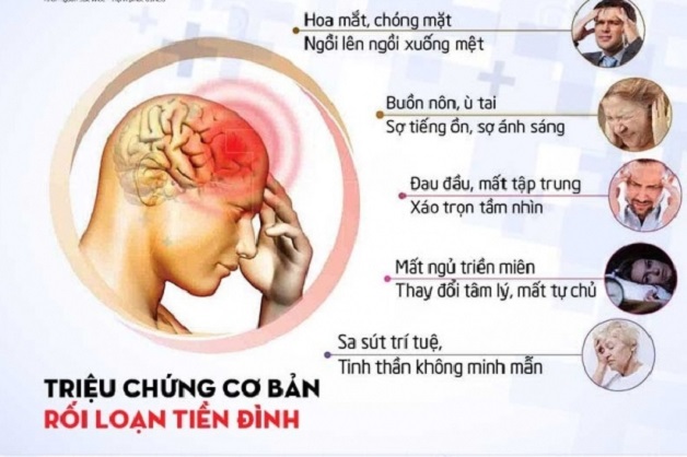 Bị rối loạn tiền đình điều trị như thế nào?