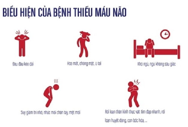 Bị rối loạn tiền đình điều trị như thế nào?