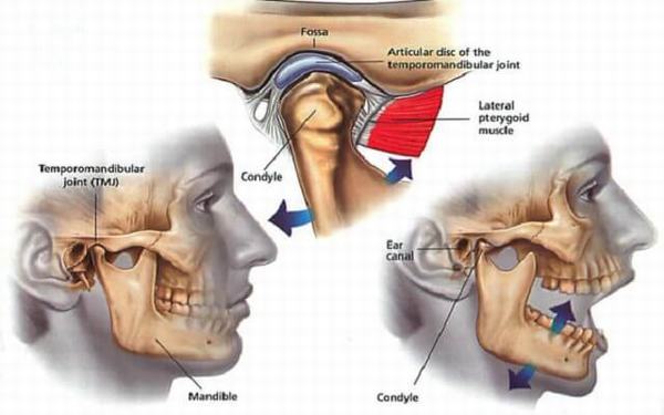 Bị sái quai hàm phải làm sao để nhanh khỏi nhất?