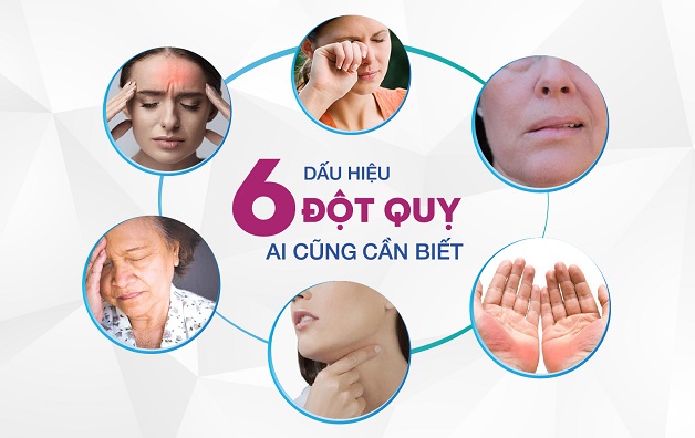 Bị tai biến mạch máu não có nguy hiểm? Dấu hiệu nhận diện