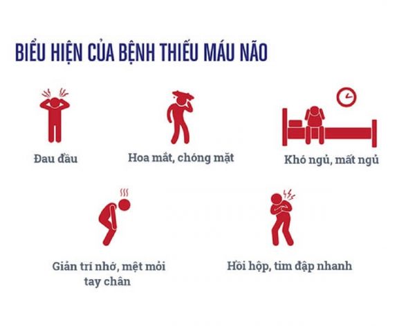 Bị thiếu máu não: Cơ chế, biểu hiện và cách xử trí