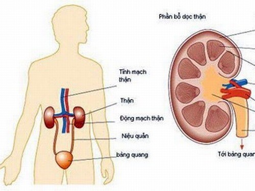 Biến chứng nguy hiểm do bệnh gout