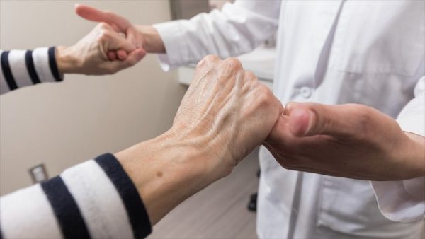 Biểu hiện bệnh Parkinson ở từng giai đoạn