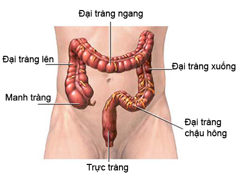 Biểu hiện của ung thư đại tràng