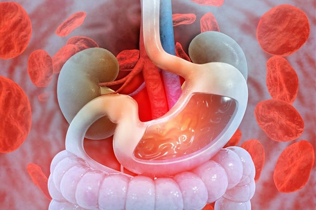 Biểu hiện của viêm loét dạ dày và cách điều trị hiệu quả