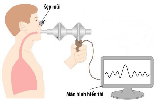 Biểu hiện hen phế quản ở trẻ mà cha mẹ cần biết