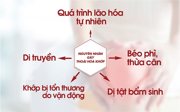 Biểu hiện, nguyên nhân và cơ chế bệnh thoái hóa khớp