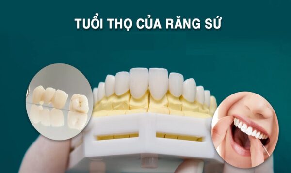 Bọc răng sứ sử dụng được bao lâu và cách chăm sóc