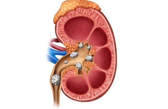 Các bệnh lý thường gặp về thận