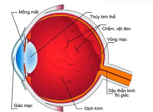 Các bệnh lý về dịch kính võng mạc có nguy hiểm không?