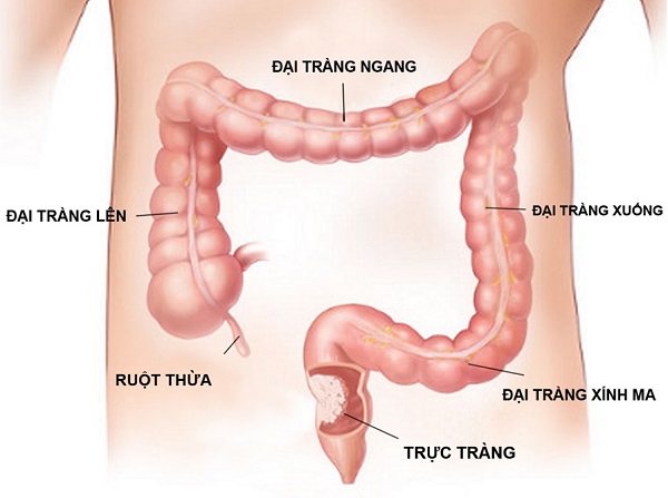 Các bệnh lý về trực tràng