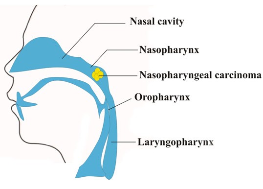 Các bệnh ung thư thường gặp nhất ở Việt Nam