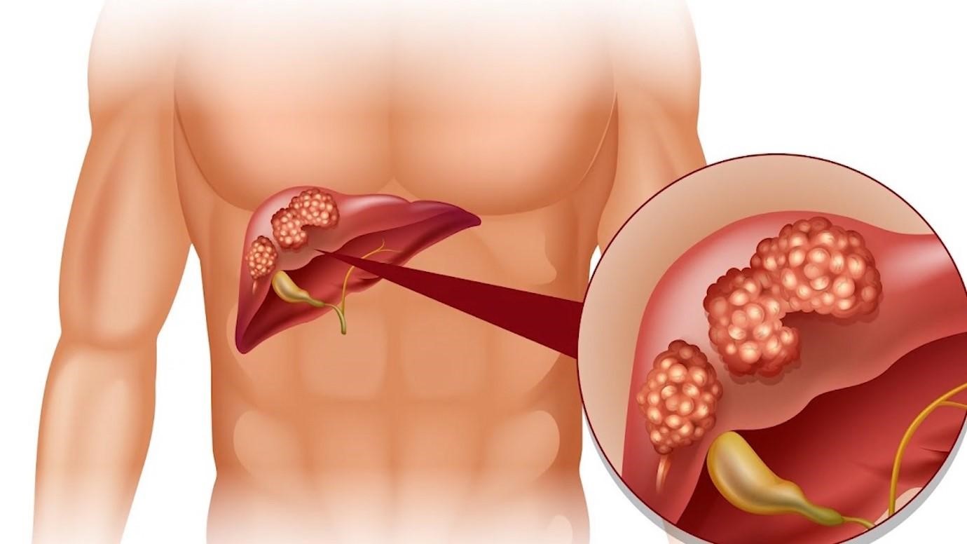 Các bệnh về lá lách thường gặp