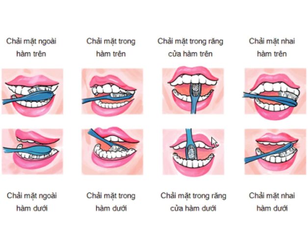 Các biện pháp chống sâu răng đơn giản không thể bỏ qua