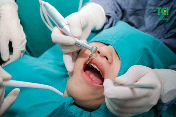 Các bước cấy ghép implant đúng chuẩn