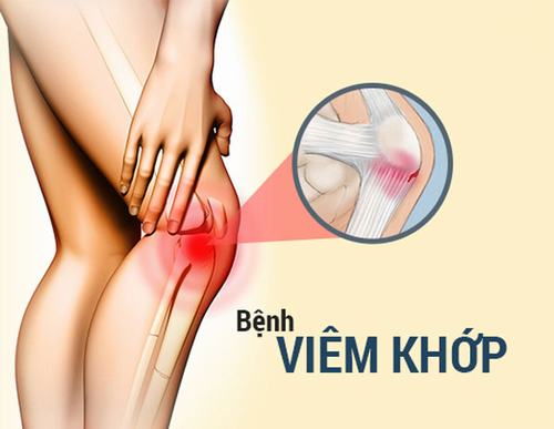 Các Dạng Viêm Khớp Chân & Phương pháp điều Trị Hiệu Quả nhất