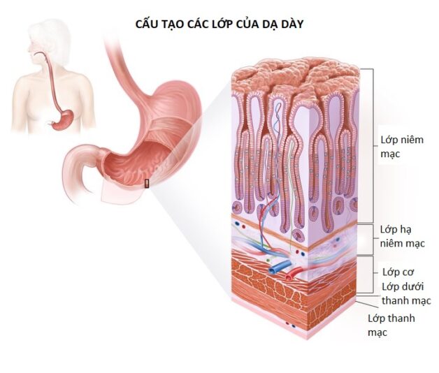 Các giai đoạn tiến triển của bệnh ung thư dạ dày