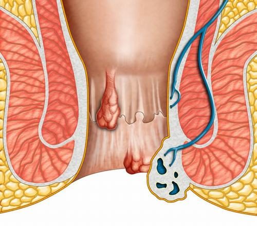 Các loại ung thư đường tiêu hóa