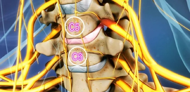 Các nguyên nhân gây đau cột sống cổ