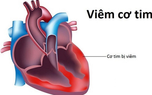 Các nguyên nhân gây đau ngực phải khó thở