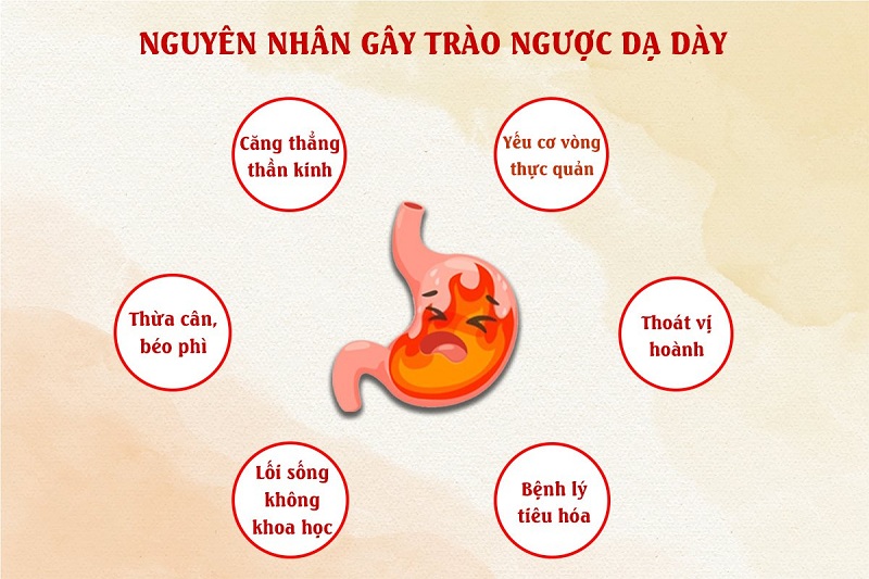 Các nguyên nhân trào ngược phổ biến và cách chẩn đoán