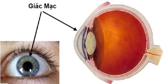 Các tật khúc xạ về mắt điều trị bằng cách nào an toàn nhất?