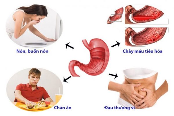 Các triệu chứng đau dạ dày có thể nhận biết sớm