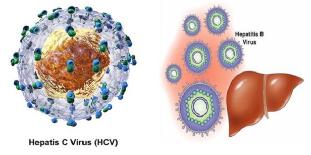 Các triệu chứng viêm gan C bạn không thể bỏ qua