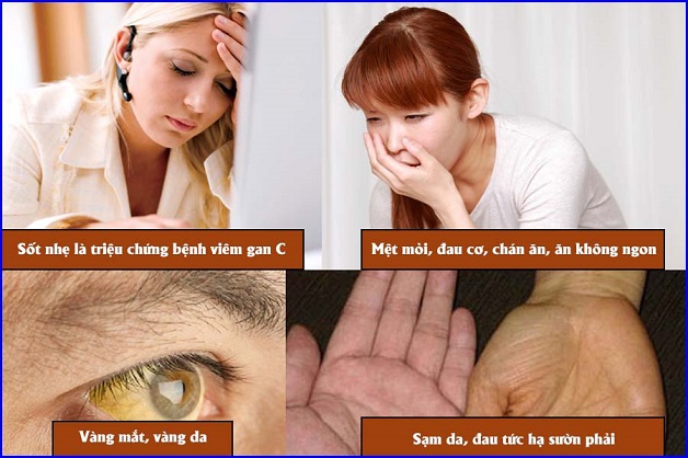 Các triệu chứng viêm gan C bạn không thể bỏ qua