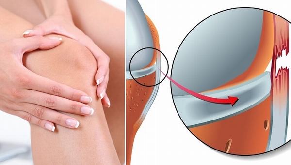 Các vị trí thường bị giãn dây chằng mà bạn có thể gặp phải