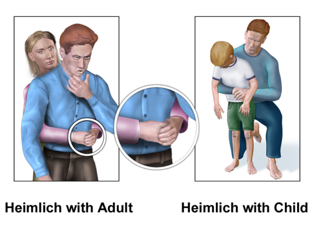 Cách chữa hóc xương cá siêu đơn giản tại nhà