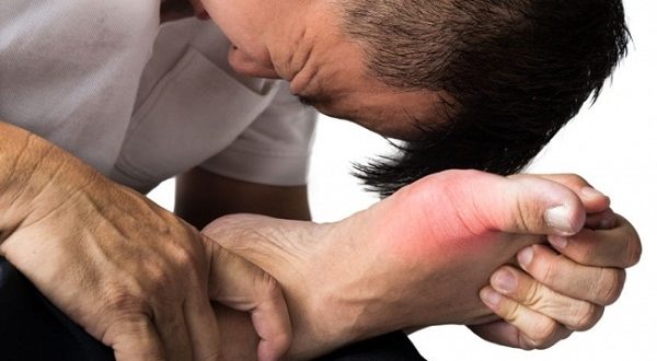 Cách điều trị bệnh Gout Hiệu Quả Triệt để nhất