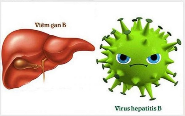 Cách điều trị viêm gan B hiệu quả nhất hiện nay