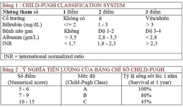 Cách đo lường mức độ xơ gan với thang điểm xơ gan Child Pugh